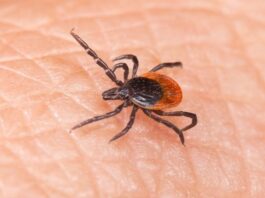 What to do if you are bitten by a tick in Bergen County NJ