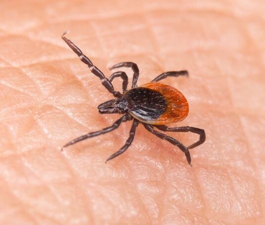 What to do if you are bitten by a tick in Bergen County NJ